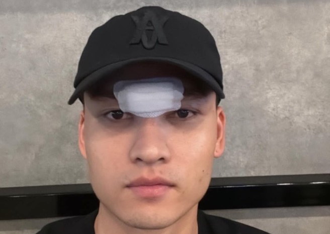 Cập nhật chấn thương của Bùi Hoàng Việt Anh