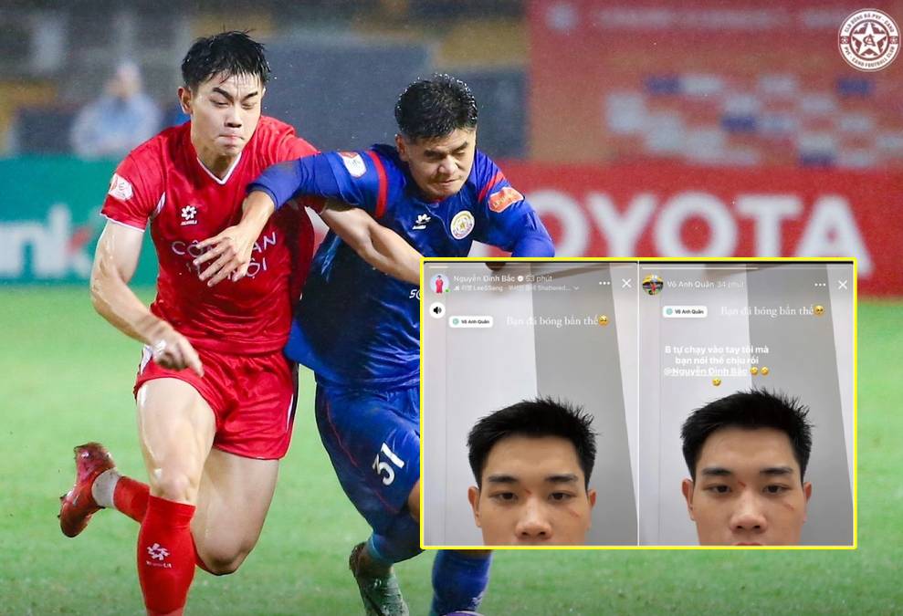 Đình Bắc đính chính sau story trách đồng đội ở U23 Việt Nam