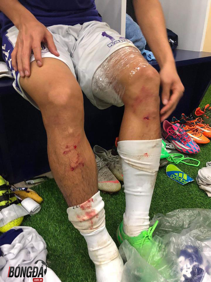 Quế Ngọc Hải vào bóng thô bạo bằng hai chân với Văn Kiên