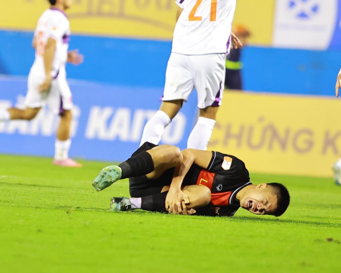 Sao Việt Kiều chấn thương, HLV Albadalejo phẫn nộ