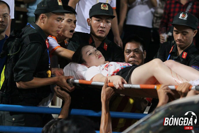 SỐC: CĐV nữ Hà Nội nhập viện sau khi dính pháo sáng của CĐV Nam Định