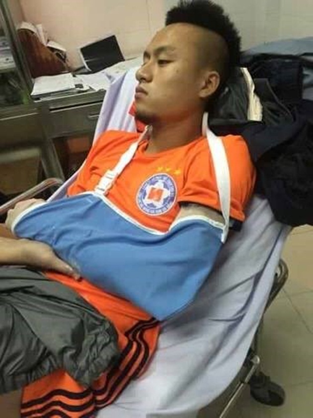 Võ Huy Toàn phải phẫu thuật 2 lần, nghỉ thi đấu 6 tháng